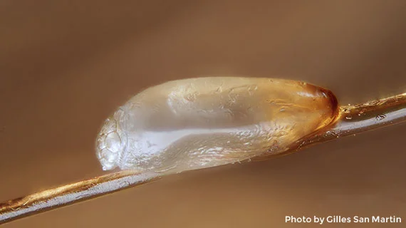Close-up view of a louse egg on hair shaft